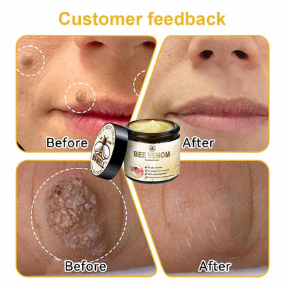 Professional Bee Venom Repair Cream, For All Body Parts