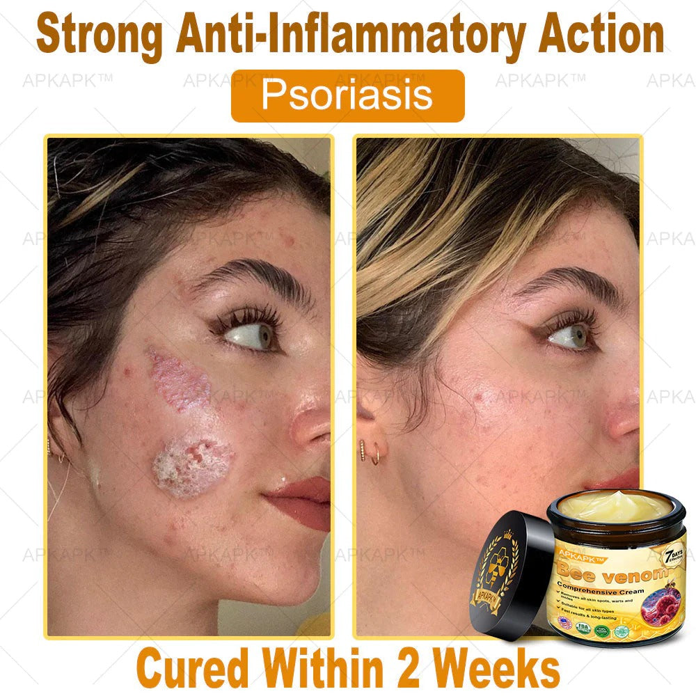 Professional Bee Venom Repair Cream, For All Body Parts