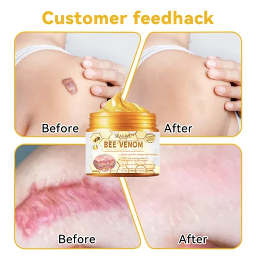 HOUKEA™Bee Venom Cream (Original)