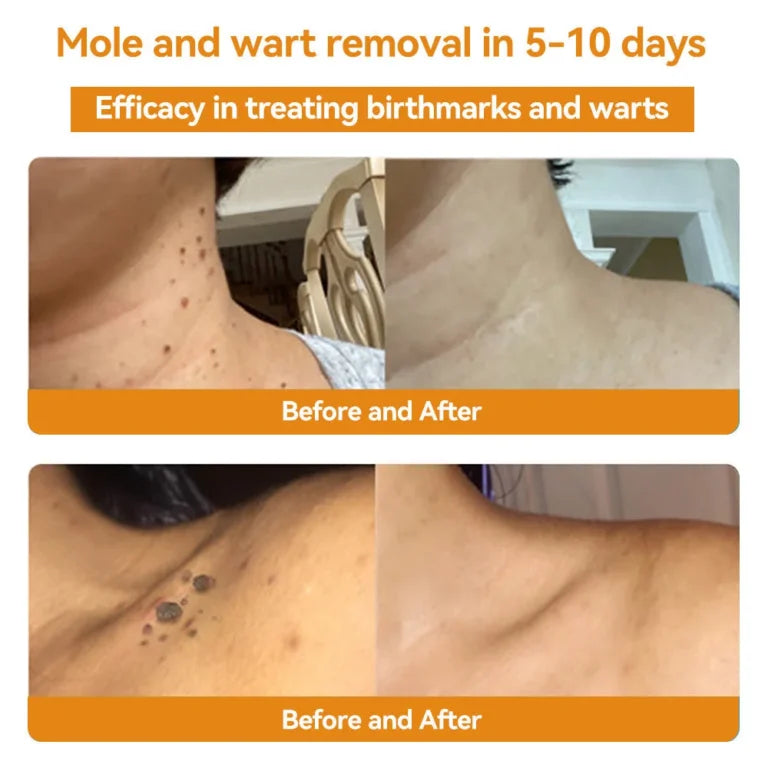 HOUKEA™Bee Venom Cream (Original)